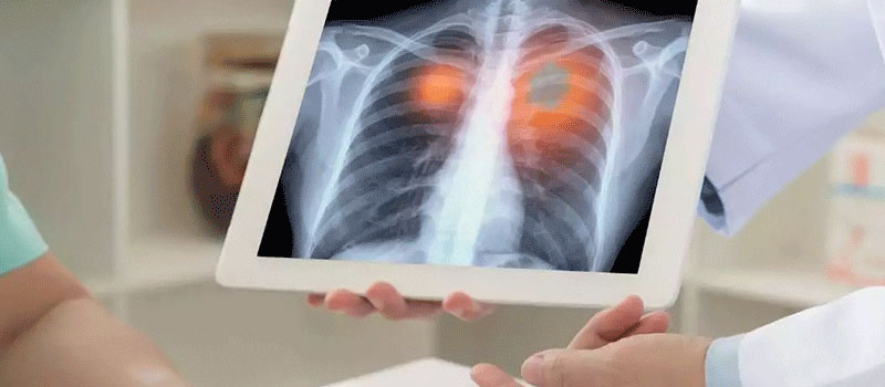 Hassle-Free Senior X-Ray Home Service in Mumbai