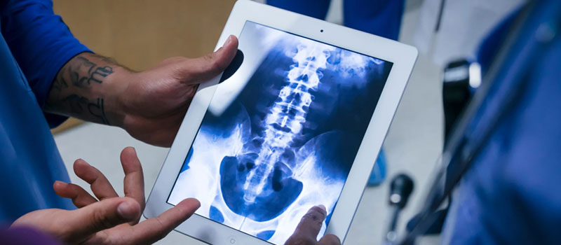Spine X-Ray at Home in Mumbai