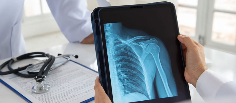 X-Ray at Home in Mumbai