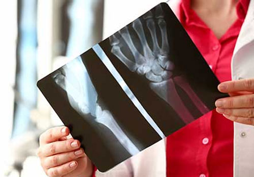 X-Ray at Home in Mumbai X-Ray at Home in Mumba